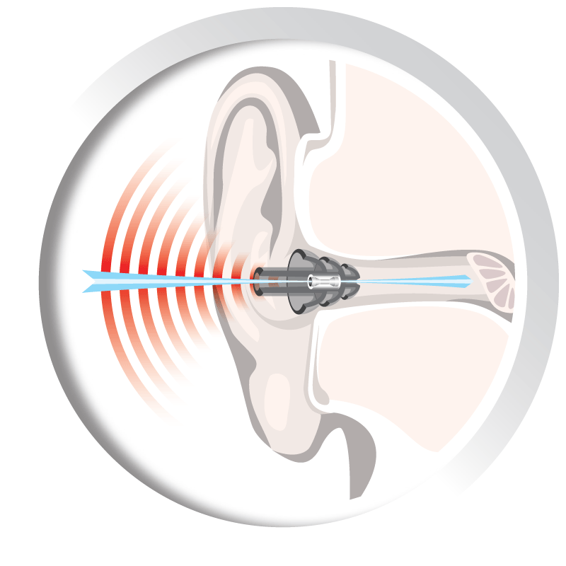 ear-diagram